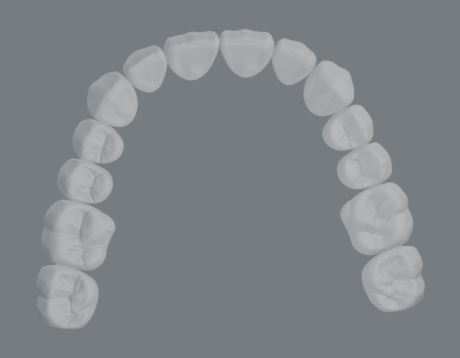 Illustrative upper dental arch, after alignment. The interactive 3D model is loading.